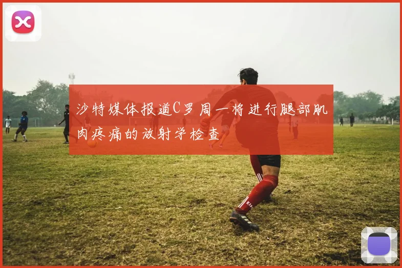 沙特媒体报道C罗周一将进行腿部肌肉疼痛的放射学检查